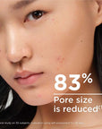 Bioderma Sebium Global Cover - 12hr Acne Coverage & Moisturizing Cream for Oily Skin