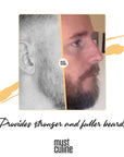 Mustculine Beard Growth Kit for Men