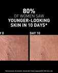 Filorga Skincare Serum - Revitalizing NCEF-Shot Concentrate for Smoother, Firmer Skin - Anti-aging Luxury Skincare Produ