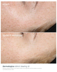 Dermalogica Retinol Clearing Oil - Anti-Aging Night Oil with Salicylic Acid for Acne and Skin Renewal