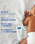 Mustela Stelatopia Intense - Non-Corticosteroid Cream | 30 ml