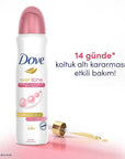 Dove Even Tone Antiperspirant Women's Spray 150ML - Smooth Skin Care | Aloe Vera & Calendula