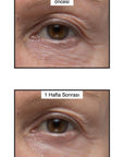Murad Renewing Eye Cream 15ml - Anti-Aging Moisturizing Eye Cream for Fine Lines & Wrinkles Murad Eye Cream for Fine Lines & Wrinkles - Anti-Aging Eye Cream, Anti-Aging, Moisturizing Eye Cream, Fine Lines and Wrinkles, Skincare, Murad, Renewing Eye Cream, Anti-Aging Skincare, Eye Care, Skincare Routine, Beauty Products, Cosmetics, Dermatologist Recommended, Anti-Wrinkle Cream, Hydrating Eye Cream