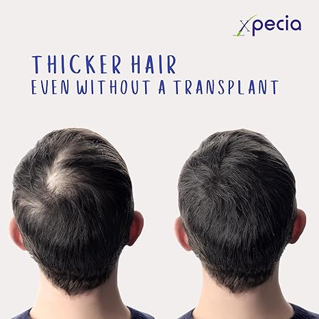 Xpecia For Men 60 Tablets - Hair Health Supplement | Men's Health - image 11