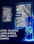 Clear Men Cool Sport Menthol Anti-Dandruff Shampoo - Itch Relief, Oily Scalp Control, Refreshing Menthol - 11.83 fl oz Clear Men Menthol Shampoo: Anti-Dandruff & Itch Relief anti-dandruff shampoo for men, clear men shampoo, menthol shampoo, shampoo for oily scalp, itchy scalp shampoo, dandruff treatment for men, cooling shampoo, Clear Men Cool Sport Menthol, men's shampoo, anti-dandruff, menthol, oily scalp, itchy scalp, dandruff, cooling, hair care, men's grooming, scalp treatment, 3ZeroTech Technology, re