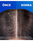 Head & Shoulders Anti-Dandruff Shampoo with Coconut Oil - Moisturizing, Dermatologically Tested - 11.16 fl oz Head & Shoulders Anti-Dandruff Shampoo with Coconut Oil - 11.16 fl oz anti-dandruff shampoo, moisturizing shampoo, coconut oil hair care, dermatologically tested shampoo, dandruff treatment shampoo, hair care, scalp care, sensitive scalp, moisturizing hair products, hair moisturizer, dandruff relief, scalp relief, gentle shampoo, coconut oil benefits