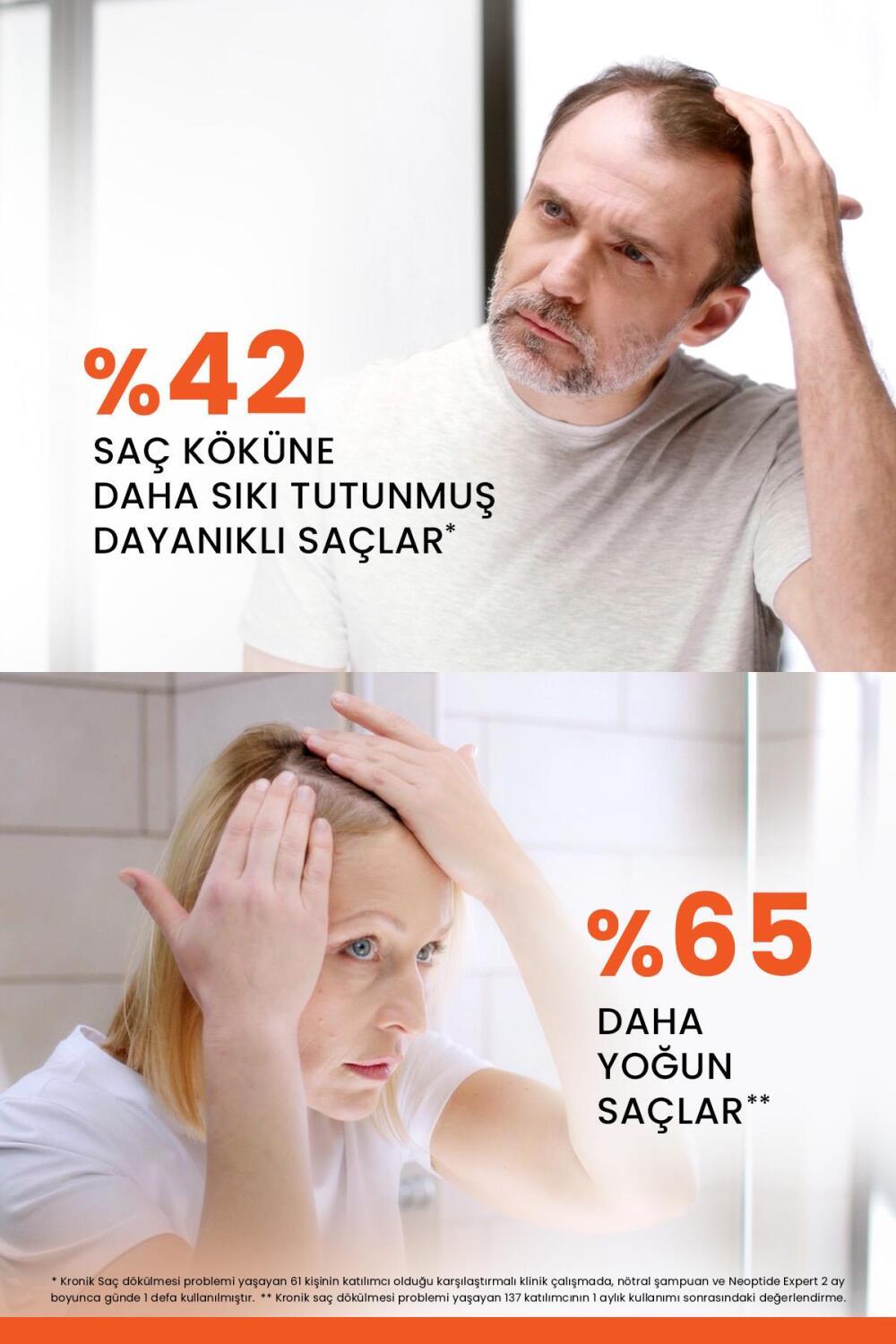 Ducray Neoptide Expert Hair Strengthening & Densifying Serum 2x50ml - Boost Hair Resilience & Density Ducray Neoptide Expert Hair Serum for Strength & Density Hair strengthening serum, Hair densifying treatment, Ducray Neoptide Expert, Hair care for thinning hair, Post hair transplant serum, Hair loss solution, Hair growth treatment, Hair care products, Cosmetic hair care, Hair density improvement, Hair health, Hair transplant care, Hair resilience, Thinning hair solution, Hair care routine, Hair strengthen