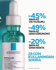 La Roche-Posay Effaclar Peeling Serum: Acne Scar, Dark Spot, & Hyperpigmentation Treatment - Salicylic & Niacinamide Serum for Even Skin Tone La Roche-Posay Acne Scar & Dark Spot Serum | Peeling For Clear Skin La Roche Posay Effaclar Serum, Acne scar treatment, Skin discoloration serum, Hyperpigmentation treatment, Peeling serum for acne, Salicylic acid serum, Niacinamide serum for face, Blemish control serum, Dark spot corrector, Exfoliating serum, Facial Serum, acne-prone skin, hyperpigmentation, dark spo