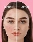 Sinoz Pink Touch SPF50+ Tone-Up Sunscreen: Color Correcting, Redness Reducing, and Brightening Mineral Facial Sunscreen with Hyaluronic Acid - 1.69 fl oz Sinoz Pink Touch SPF50 Sunscreen: Tone-Up & Color Correcting pink sunscreen, tone-up sunscreen, color correcting sunscreen, SPF50 sunscreen for face, sunscreen for redness, sunscreen for sensitive skin, brightening sunscreen, mineral sunscreen, facial sunscreen, sun protection, redness reduction, even skin tone, hyaluronic acid, niacinamide, bright oleoact