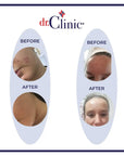 dr.Clinic Vitamin C Facial Day Cream | Moisturizer for Dry