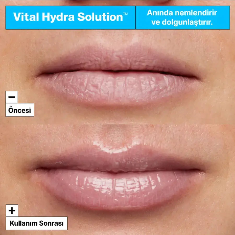 Dr. Jart+ Vital Hydra Solution Lip Mask with Hyaluronic Acid 20ml