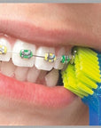 Curaprox CS 5460 Orthodontic Toothbrush for Braces Care - Effective Cleaning Around Orthodontic Appliances Curaprox CS 5460 Orthodontic Toothbrush for Effective Braces Care Orthodontic Toothbrush, Curaprox CS 5460, Braces Toothbrush, Orthodontic Oral Care, Specialized Dental Hygiene, Orthodontic Treatment, Braces Care, Oral Hygiene, Dental Hygiene, Toothbrush for Braces, Manual Toothbrush, Curaprox, Orthodontic Appliances