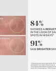 DR.Murad Dark Spot Correcting Serum - Rapidly Reduces Hyperpigmentation, Evens Skin Tone, 30ml - view 4