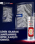 Clear Men FIFA World Cup Anti-Dandruff Shampoo 330 ml