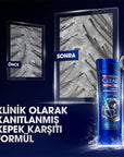 Clear Men: Intense Clean Anti-Dandruff Charcoal Shampoo - Deeply Cleanses Oily, Itchy Scalp & Controls Dandruff for Men - 11.83 fl oz Clear Men Charcoal Shampoo: Anti-Dandruff, Deep Cleanse anti-dandruff shampoo, men's shampoo, charcoal shampoo, deep cleansing shampoo, shampoo for oily scalp, shampoo for itchy scalp, kepek şampuanı, men's anti dandruff shampoo, purifying shampoo, oil control shampoo, shampoo, men's hair care, dandruff treatment, itchy scalp relief, oily scalp solution, charcoal, taurine, am