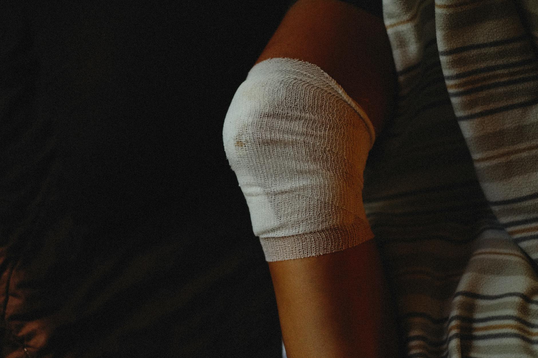 A detailed view of a bandaged knee indicating injury care and healing process.