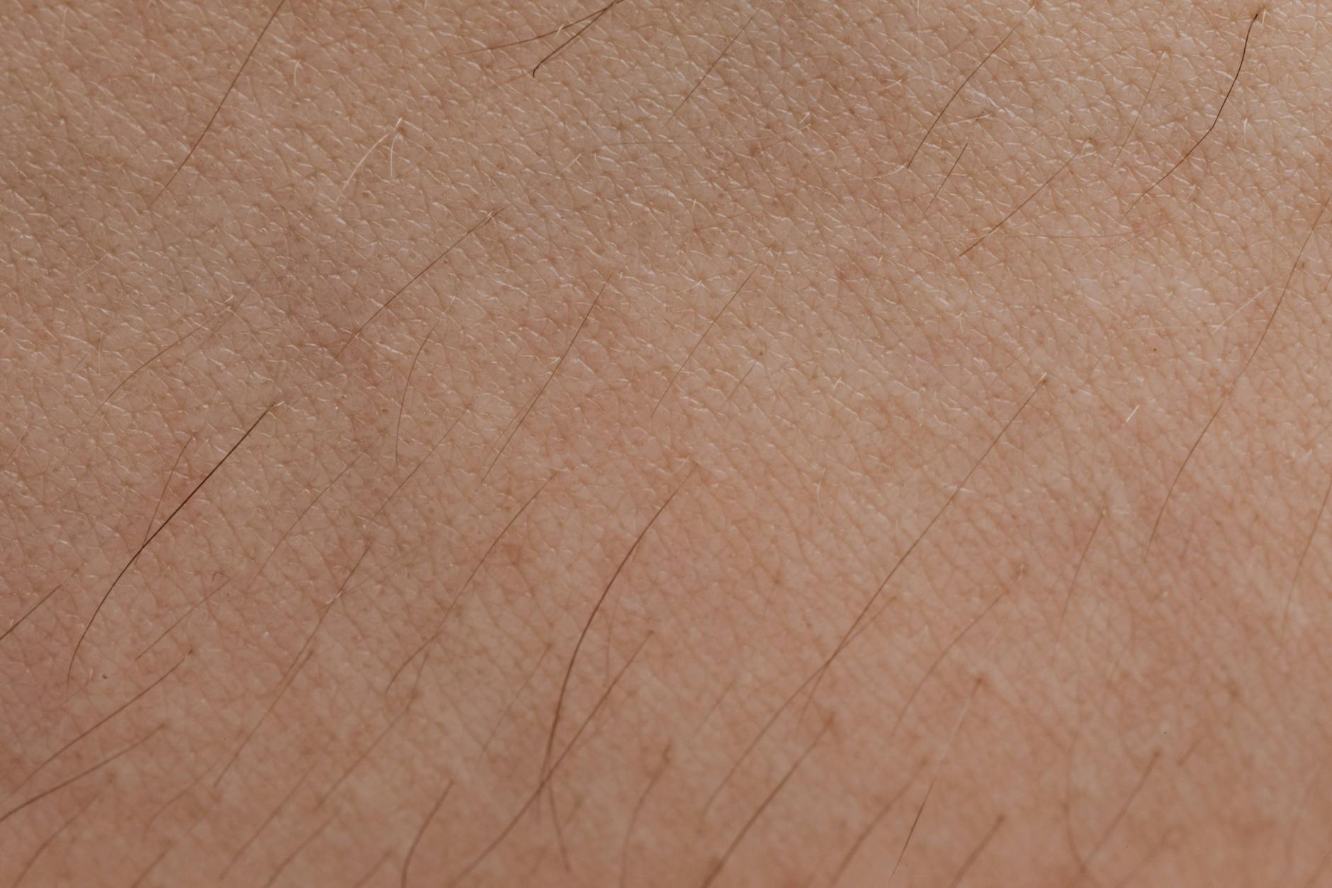 Rough Skin Texture Causes, Treatments & Best Products | Beauty Care Bag