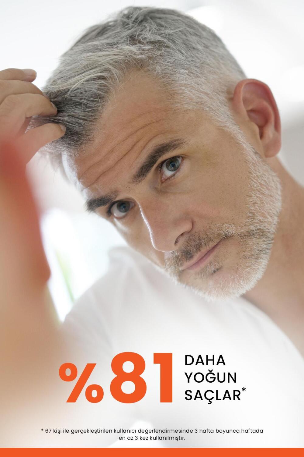 Ducray Anaphase+ Anti-Hair Loss Shampoo - Strengthens Hair, Biodegradable Formula - 13.53 fl oz Ducray Anaphase+ Anti-Hair Loss Shampoo - Strengthens & Nourishes anti-hair loss shampoo, Ducray Anaphase+, hair loss treatment, daily shampoo, biodegradable shampoo, hair care, hair strengthening, hair growth, eco-friendly shampoo, Biotin, Ruscus Aculeatus Root Extract, Zinc Pyrithione, hair loss solution, hair thickening, vitamin complex shampoo
