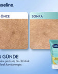 Vaseline Gluta-Hya Smooth Body Lotion: Brighten, Smooth, & Hydrate Dry Skin | Niacinamide, AHA, BHA, PHA, Hyaluronic Acid - Non-Greasy Formula Vaseline Gluta-Hya: Smooth & Bright Body Lotion - Dry Skin Savior body lotion, smoothing body lotion, skin brightening lotion, dry skin moisturizer, Niacinamide body lotion, AHA BHA PHA lotion, GlutaGlow lotion, Hyaluronic acid body lotion, non-greasy body lotion, blemish reducing body lotion, moisturizing lotion, radiant skin, smooth skin, skin renewal, hydration, d