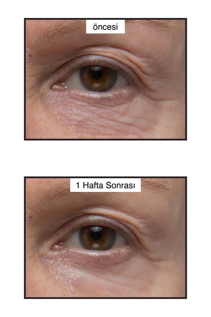 Murad Age Reform Rapid Collagen Infusion Collagen Serum - Anti-aging Hydrating Serum for All Skin Types - view 3