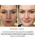 Epify Glutathione Shot usage