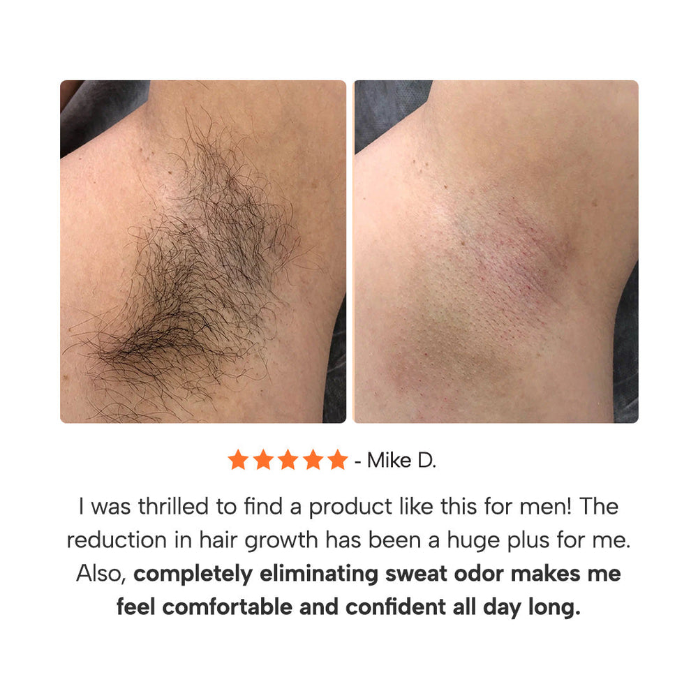 Epify 3-in-1 Underarm Roll-On usage