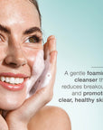 Skincode SOS Oil Control Clarifying Wash 125ml - Gentle Facial Cleanser with Salicylic Acid for Acne Control