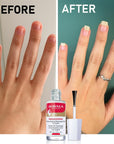 Mavala Mavaderma Massage Oil For Nails - Nourishing Nail Care Oil for Healthy Growth (10ml)