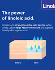 Linola Gentle Shampoo for Sensitive Scalp - 200 ml, Linola Hair Care