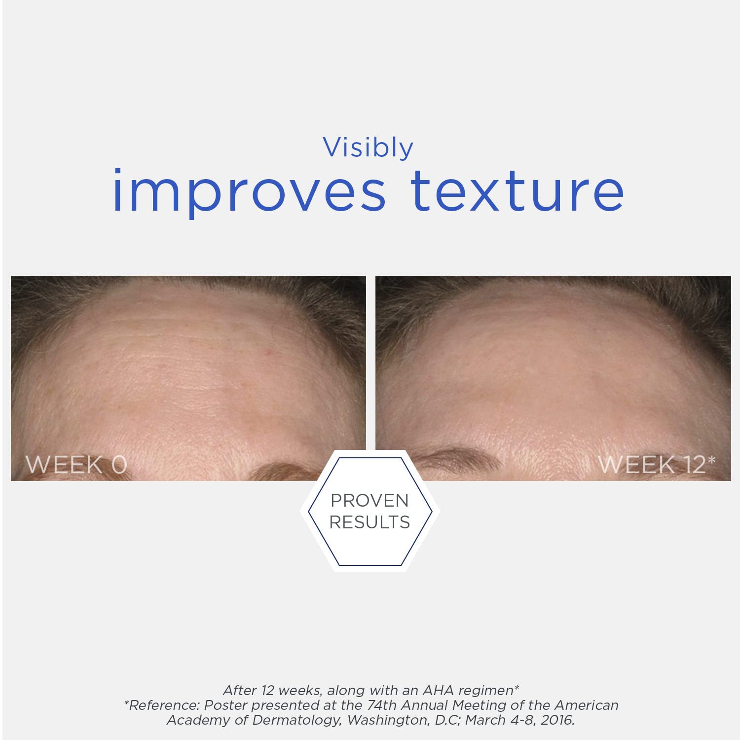 Neostrata Resurface Smooth Daily Exfoliating Peel Pads - Glycolic Acid Skincare for Smoother Skin, 36-Day Supply, 2.03 f
