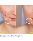 Maruderm Niacinamide 10% Spot Treatment Cream 200ml - Pore Minimizer