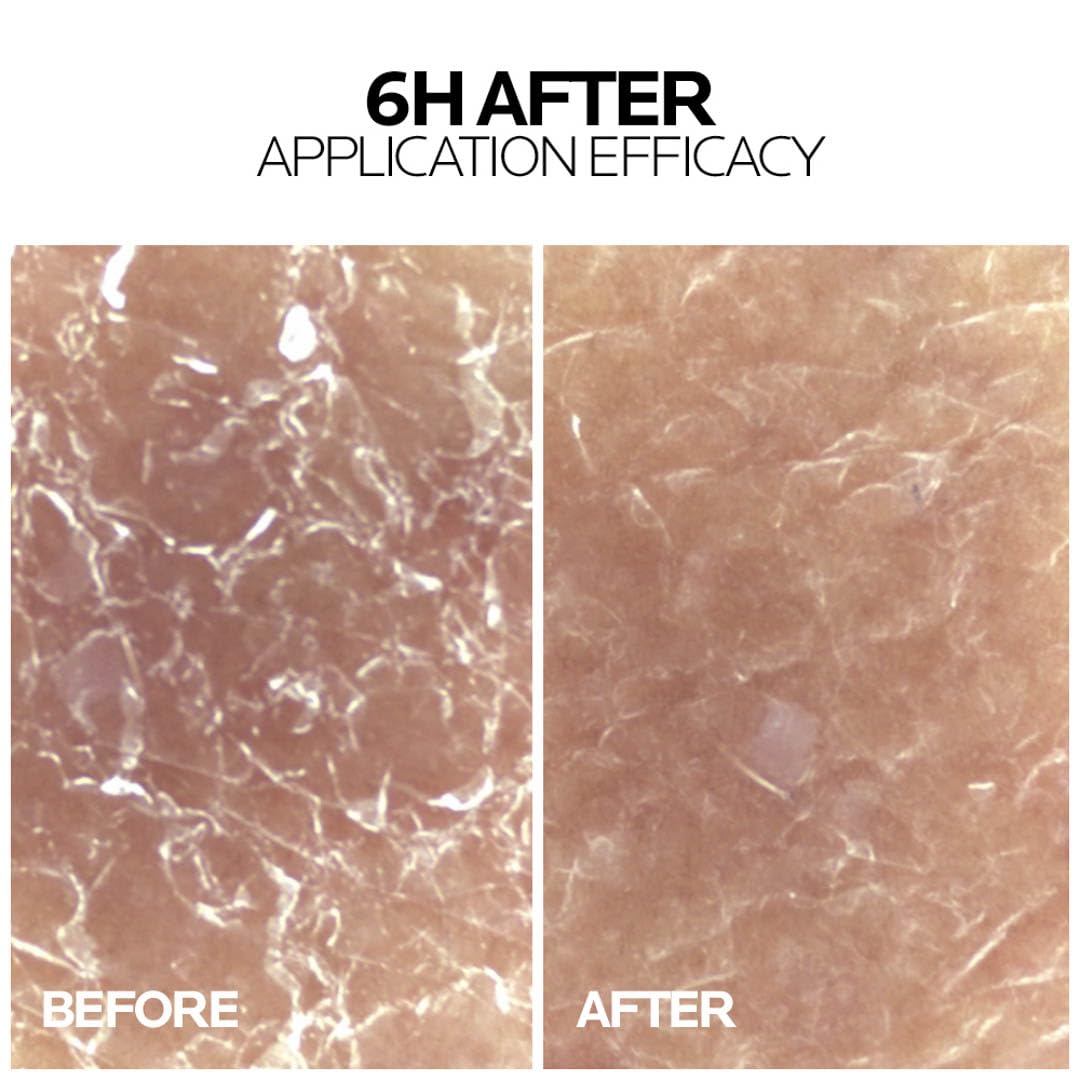 La Roche Posay Lipikar Baume APM+ Moisturizer for Very Dry and Skin Prone to Atopy - image 10