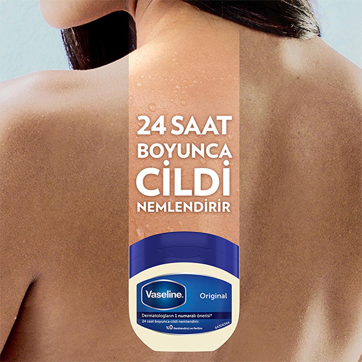 Vaseline Original Moisturizing Jelly - 24 Hour Hydration for Dry Skin, Hypoallergenic & Dermatologist-Recommended Vaseline Original Moisturizing Jelly - Long Lasting Hydration Vaseline Original Moisturizing Jelly, dry skin moisturizer, hypoallergenic moisturizer, dermatologist-recommended, long-lasting hydration, moisturizing jelly, skin care, dry skin relief, sensitive skin, non-comedogenic, 24-hour moisturization