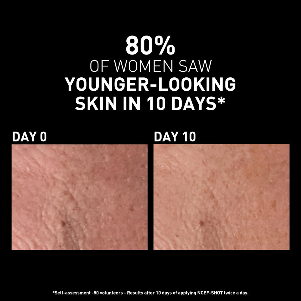 Filorga Skincare Serum - Revitalizing NCEF-Shot Concentrate for Smoother, Firmer Skin - Anti-aging Luxury Skincare Produ