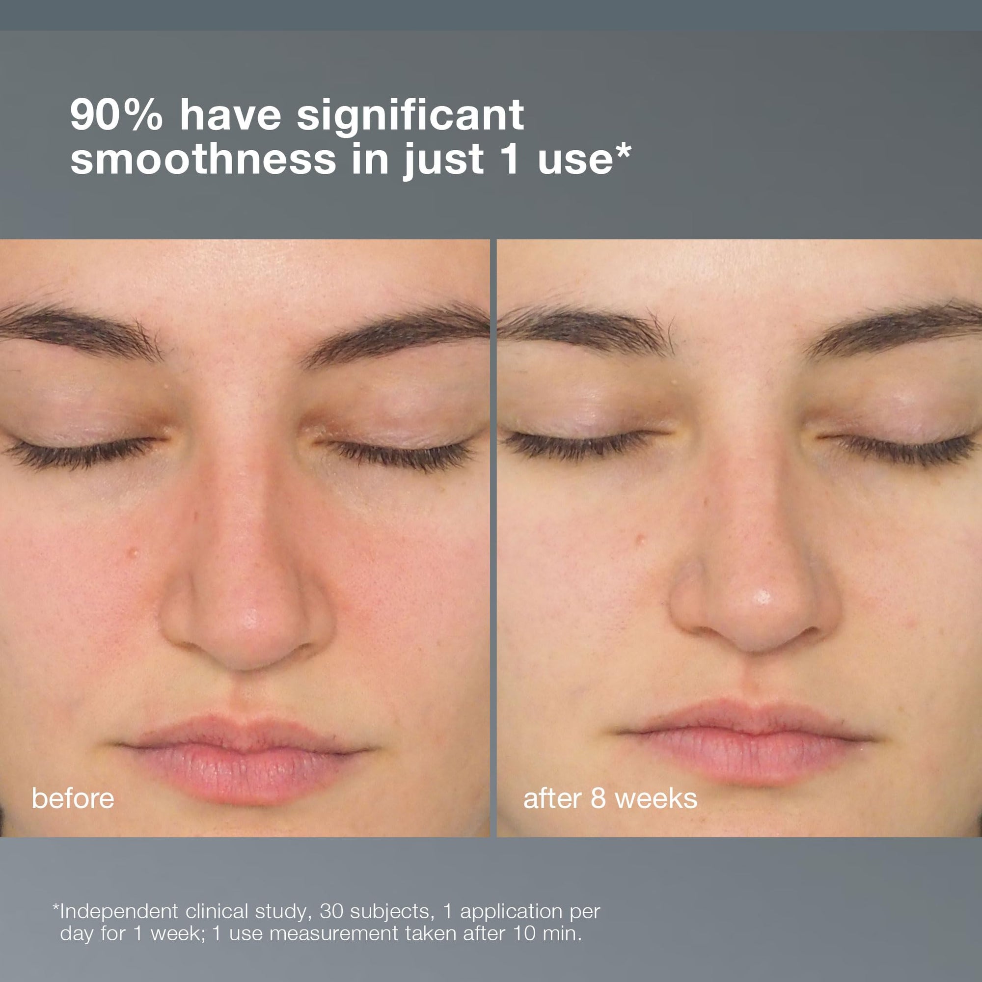 Dermalogica Daily Milkfoliant Exfoliating Powder - Gentle Natural Skincare for Sensitive Skin, Soothes & Nourishes with 
