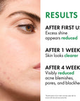 Vichy Normaderm Phytosolution Intensive Purifying Gel for Oily Skin - 400ml, Salicylic Acid Face Wash, Botanical Face Cl