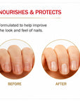 Mavala Mavaderma Massage Oil For Nails - Nourishing Nail Care Oil for Healthy Growth (10ml)