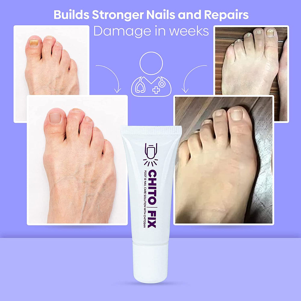 Chitofix Nail Care Cream with Chitosan - Extra Strength Formula for Toenail and Fingernail - view 5
