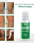 Varino Leg Tightening Lotion, Circulation and Vein Support for Healthy Legs - view 5