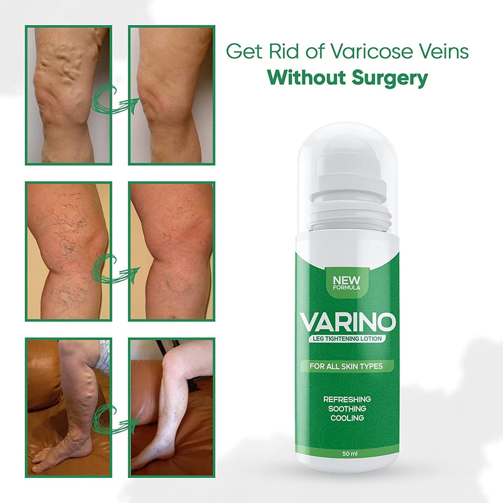 Varino Leg Tightening Lotion, Circulation and Vein Support for Healthy Legs - view 5