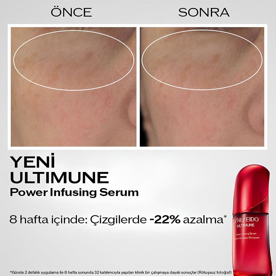 Shiseido Ultimune Power Infusing Concentrate Serum 120ml