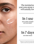 Neutrogena Soothing Clear Oil-Free Moisturizer 75ml - Lightweight Formula | Gel Texture