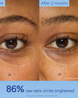 Caudalie Vinoperfect Brightening Eye Cream - Dark Circle Treatment & Anti-aging Eye Care