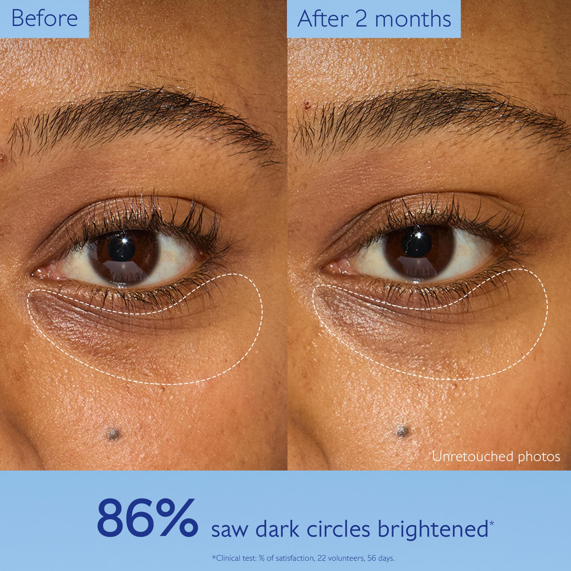 Caudalie Vinoperfect Brightening Eye Cream - Dark Circle Treatment &amp; Anti-aging Eye Care