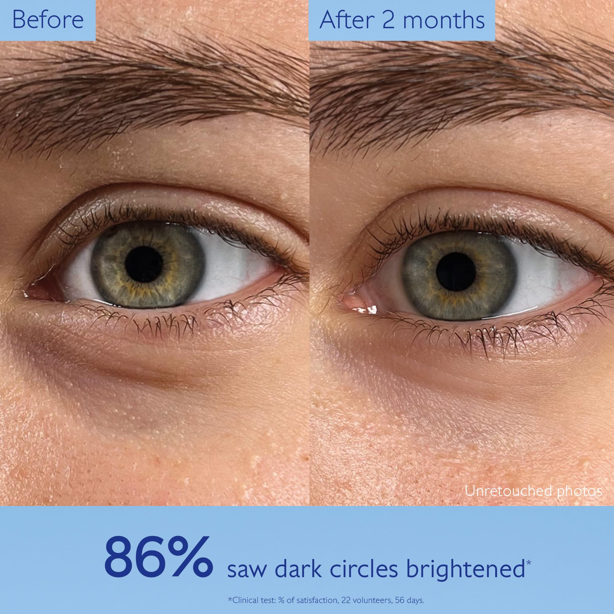 Caudalie Vinoperfect Brightening Eye Cream - Dark Circle Treatment &amp; Anti-aging Eye Care