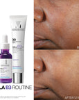 La Roche Posay MELA B3 Dark Spot Anti Serum 30 ml