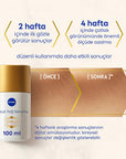 NIVEA Luminous Stretch Mark Serum - Body Moisturizer for Stretch Marks with LUMINOUS630, Long-Lasting Hydration & - view 5