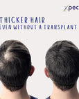 Xpecia For Men 60 Tablets - Hair Health Supplement | Men's Health - image 11