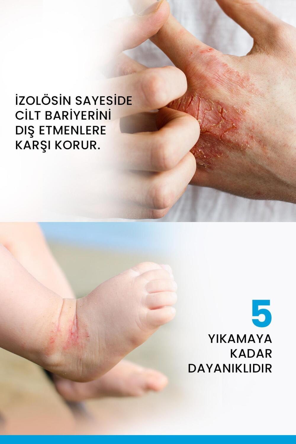 Ducray Dexyane: Barrier Cream for Dry, Atopic Skin - Strengthen, Soothe & Protect | Moisturizing Cream for Dermatitis Ducray Dexyane: Best Barrier Cream for Dry, Atopic Skin barrier cream, dry skin cream, atopic skin cream, skin barrier strengthening cream, Ducray Dexyane, soothing cream for dry skin, moisturizing cream for atopic dermatitis, dry skin, atopic skin, skin barrier, moisturizing, soothing, protecting, eczema, dermatitis, sensitive skin, skin irritation, redness relief, itching relief, skin care