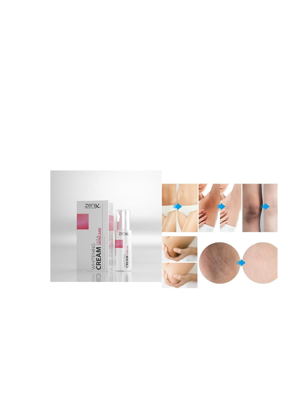 Zenix Whitening Brightening Cream 75 ml (5 pack) - Whitening Brightening Cream For Private Area And Underarm Darkening